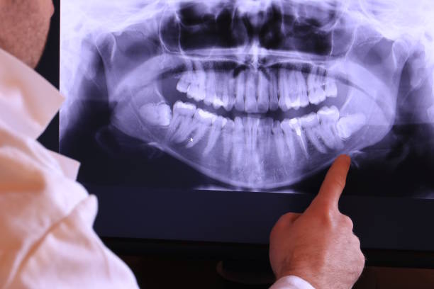 Best Cosmetic Emergency Dentistry in Richmond Hill, GA