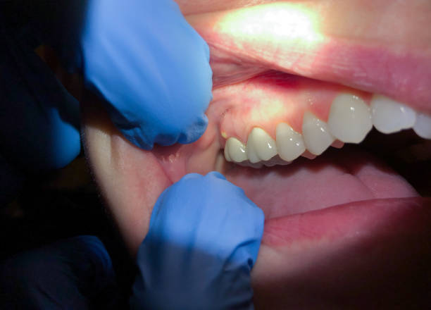  Richmond Hill, GA Emergency Dentist Pros