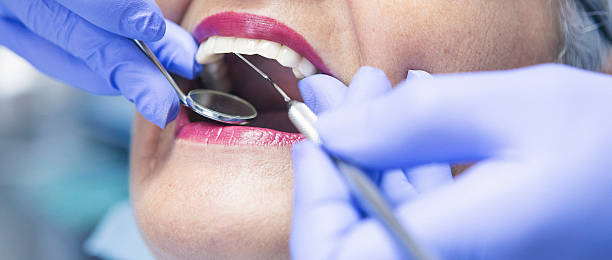 Best Emergency Treatment for Dental Infections or Abscesses in Richmond Hill, GA