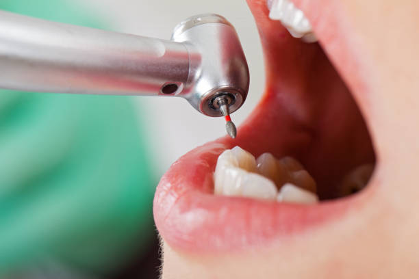 Best Weekend Emergency Dentist in Richmond Hill, GA